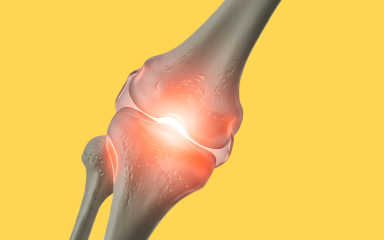 Dominando Lesões no Joelho Um Guia Abrangente para Especialistas